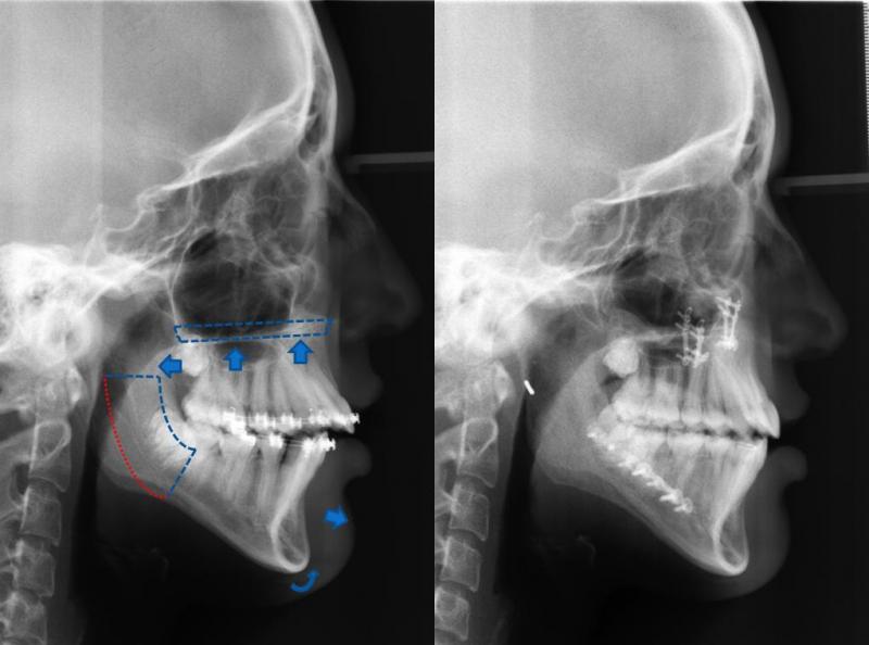 ortognatik panaromik