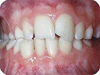 �apraz kapan��