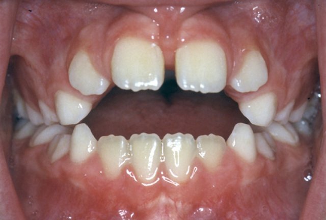 a��k kapan��