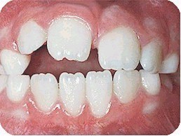 parmak emme al��kanl���